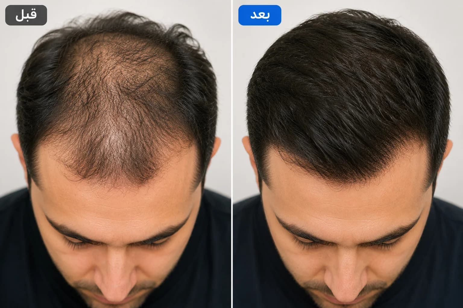 کاشت مو، PRP و خدمات پوست